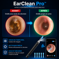 EarClean Pro™ – Nettoyage d’Oreilles avec Caméra HD