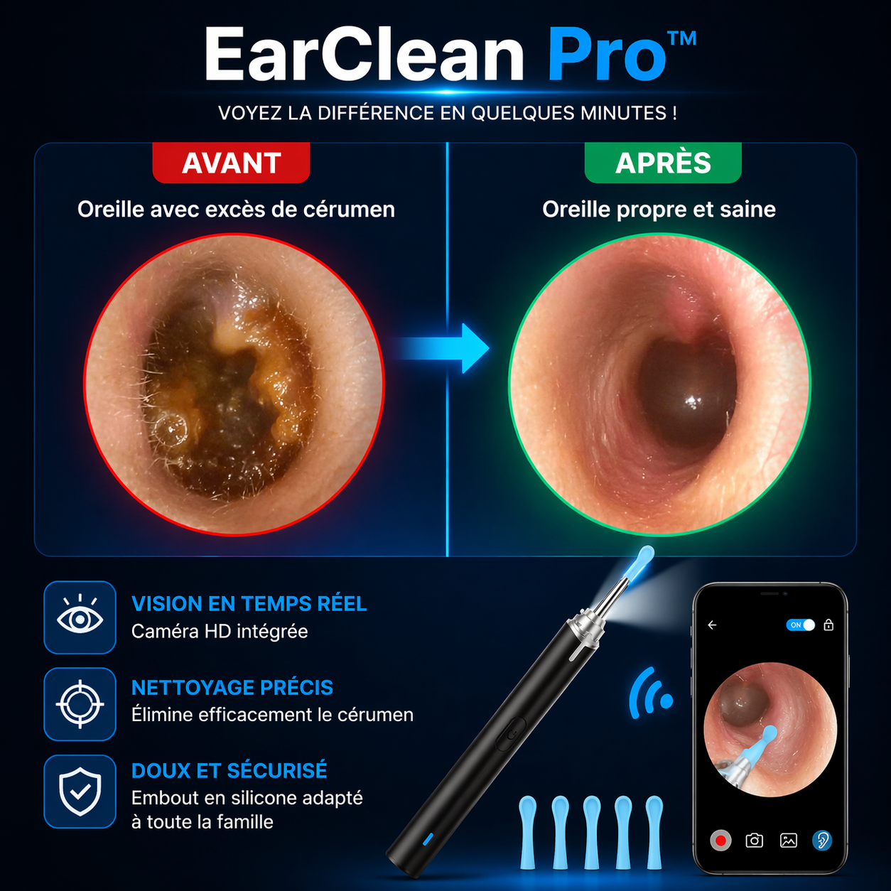 EarClean Pro™ – Nettoyage d’Oreilles avec Caméra HD